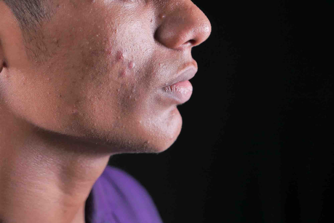 Essential Serum Spot Treatment