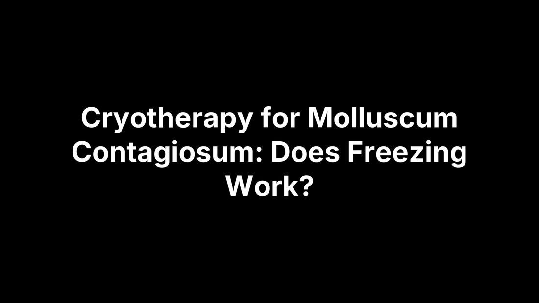 Cryotherapy for Molluscum Contagiosum: Does Freezing Work?