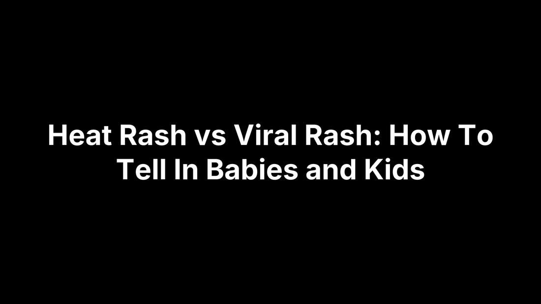 Sweat Rash Vs. Heat Rash Heat Rash vs Viral Rash: How To Tell In Babies and Kids – Pimple.Care