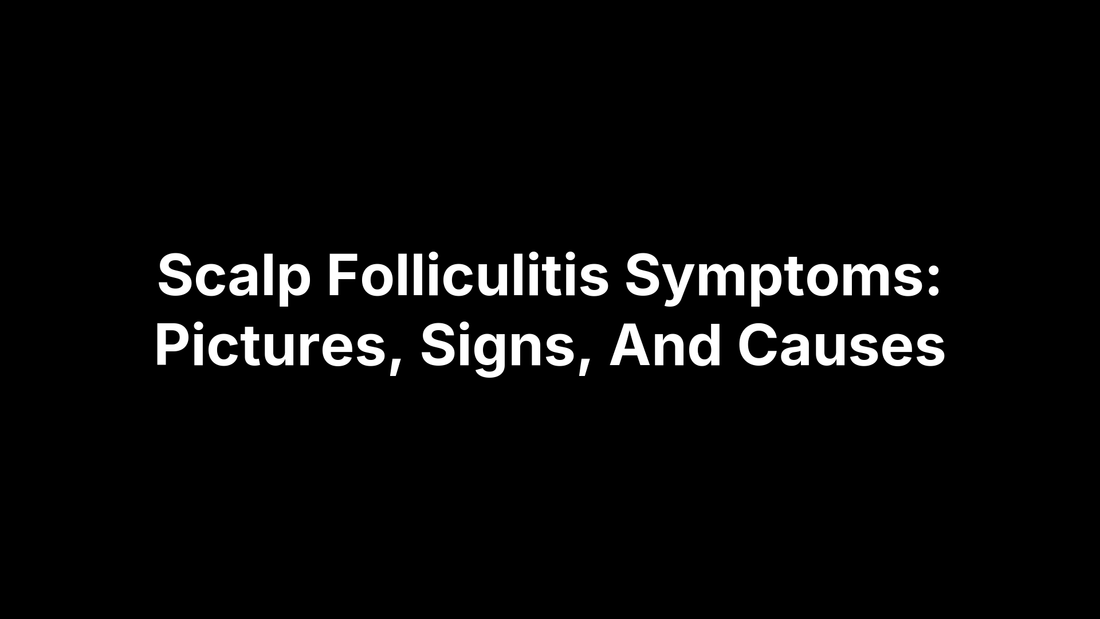 Scalp Folliculitis Symptoms: Pictures, Signs, And Causes